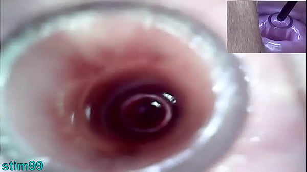 Lesbians Extreme Cervix Play and Peehole Fucking Penis Dildo